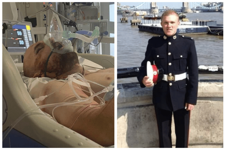 Sean (left) in Stoke Hospital after the crash,  (right) as a marine